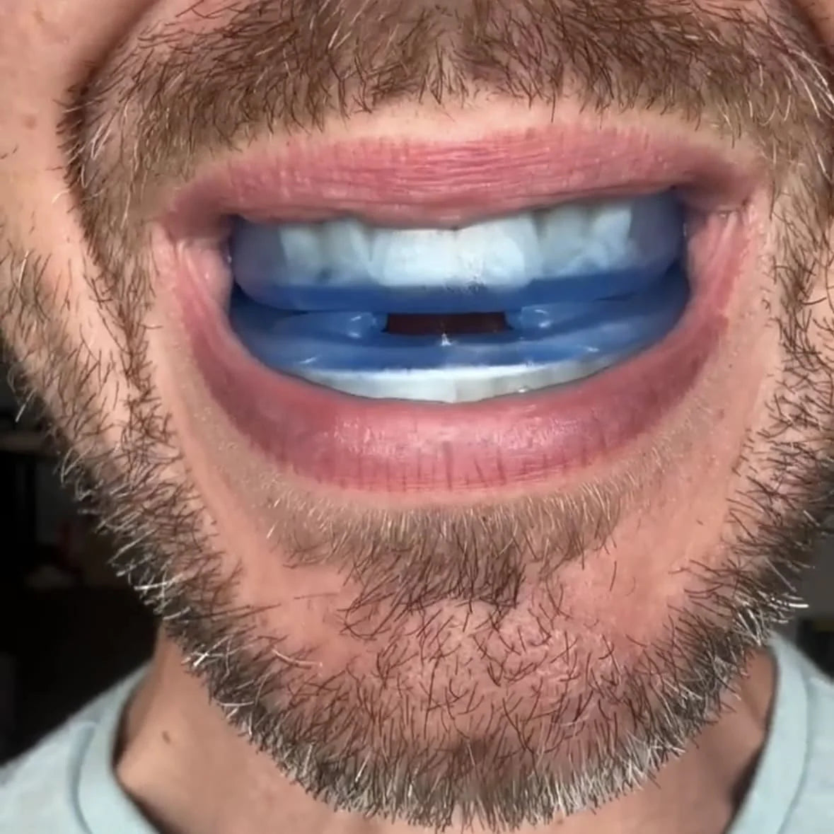 BruxProtect™ - Controla el bruxismo y despierta sin dolor