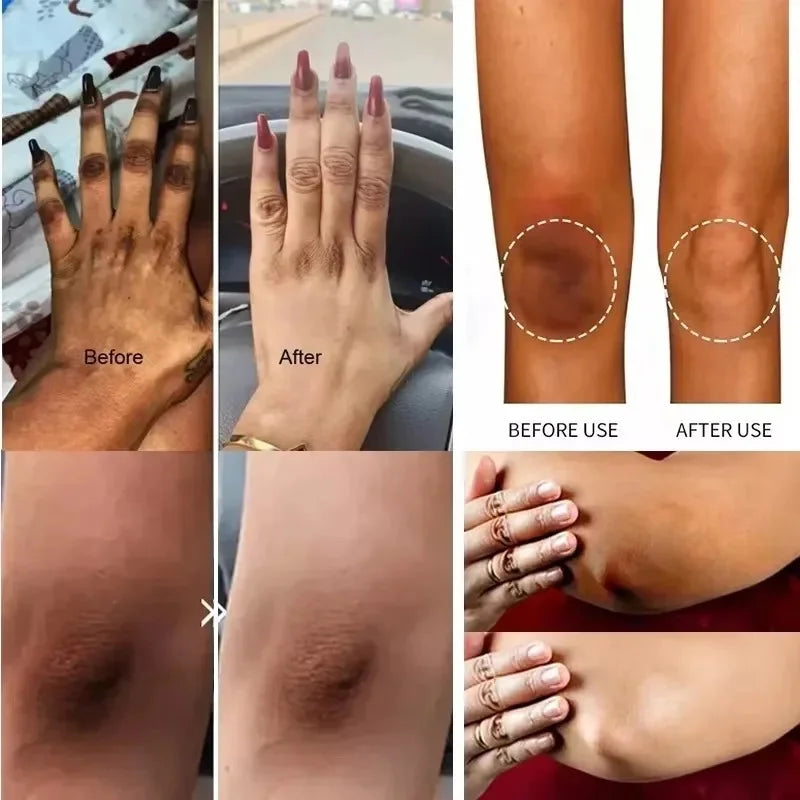 Crema Blanqueadora LumiGlow™ – Íntima y Corporal