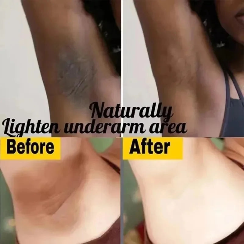 Crema Blanqueadora LumiGlow™ – Íntima y Corporal