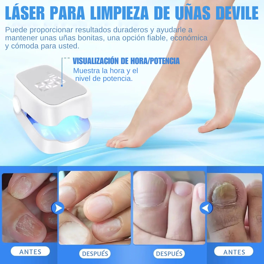 ClearNail™ – Elimina la micosis y recupera unas uñas claras en semanas
