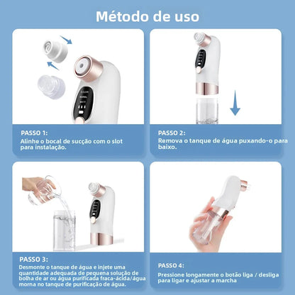 Removedor de Puntos Negros Eléctrico con Burbujas de Agua – Limpieza Facial Profunda y Succión al Vacío