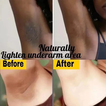 Crema Blanqueadora LumiGlow™ – Íntima y Corporal