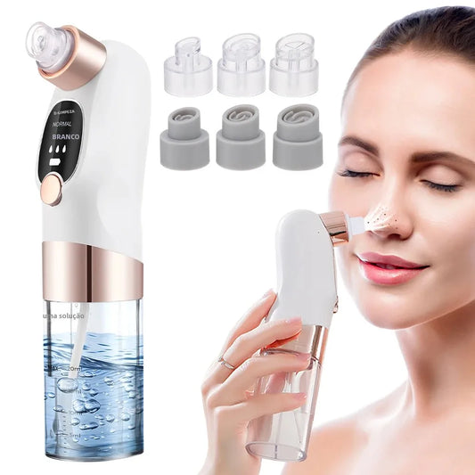 Removedor de Puntos Negros Eléctrico con Burbujas de Agua – Limpieza Facial Profunda y Succión al Vacío
